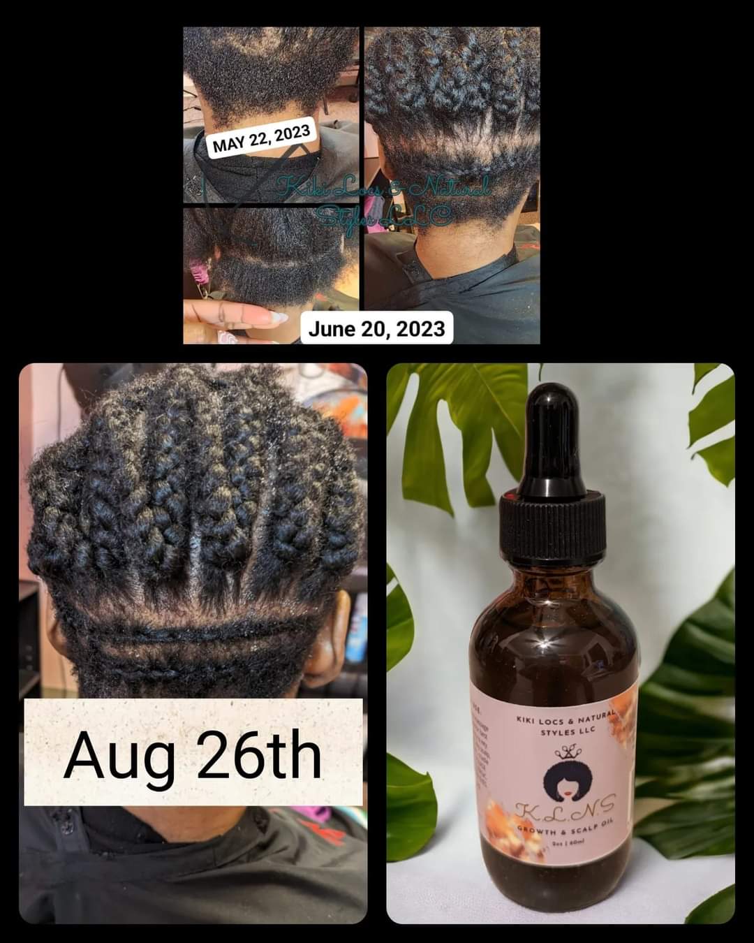 K.L.N.S Hair Growth Oil